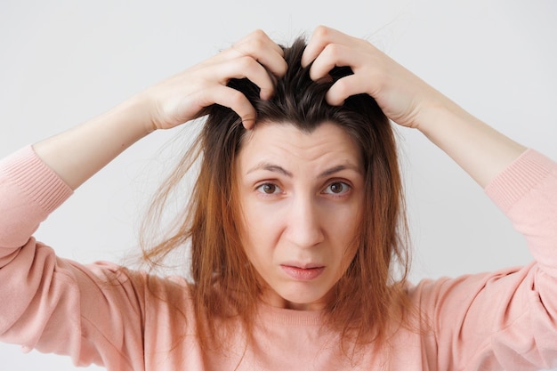 Unhappy young woman scratches head with hands caused by dandruff pediculosis and seborrhea feels dis