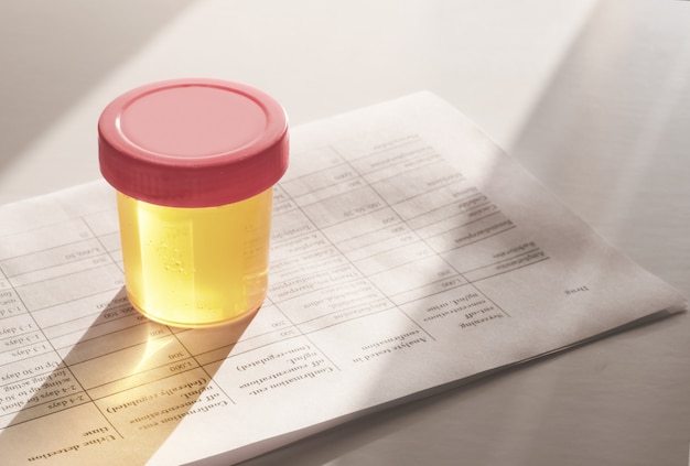 Urine in plastic container