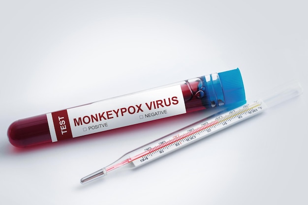 Vacutainer with monkeypox blood sample for testing