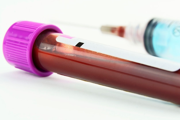 vacuum tubes for collection and blood samples and a syringe isolated on background selective focus