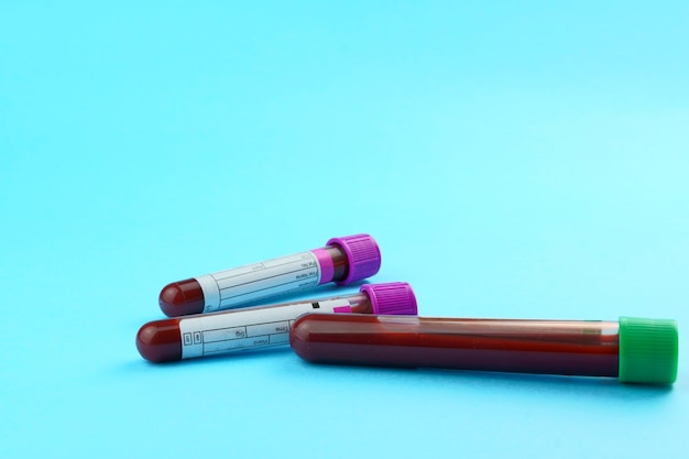 vacuum tubes for collection and blood samples and a syringe isolated on background selective focus