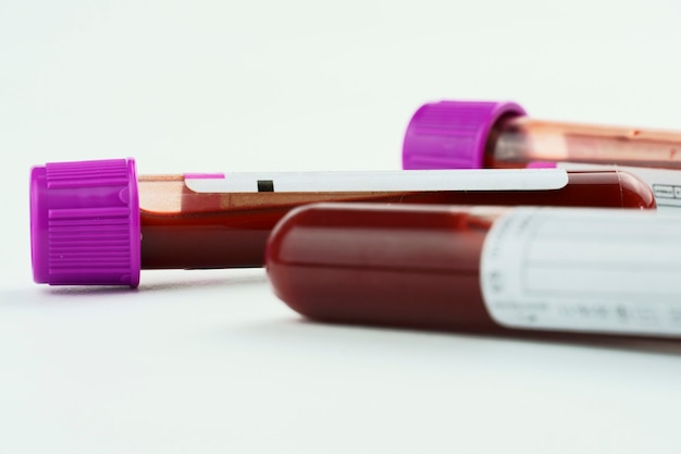 vacuum tubes for collection and blood samples and a syringe isolated on background selective focus