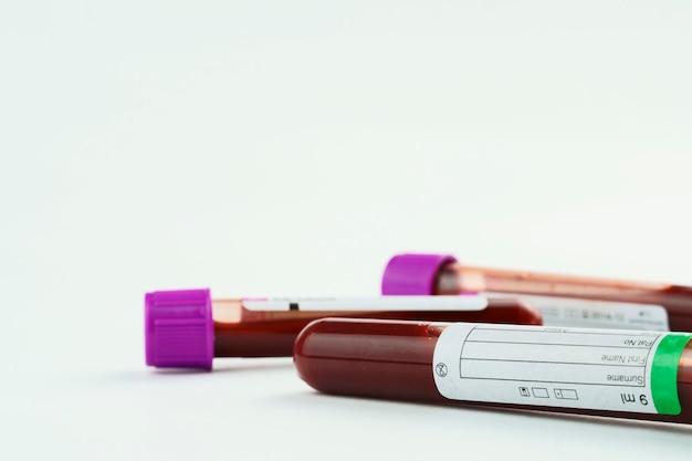 vacuum tubes for collection and blood samples and a syringe isolated on background selective focus