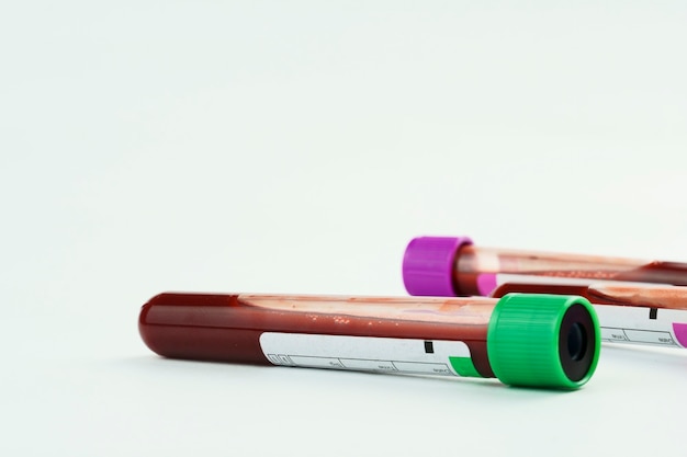 vacuum tubes for collection and blood samples and a syringe isolated on background selective focus