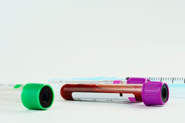 Vacuum tubes for collection and blood samples and a syringe on white background. Transparent tubes with purple and green lid. Label to identify the data. Selective focus.