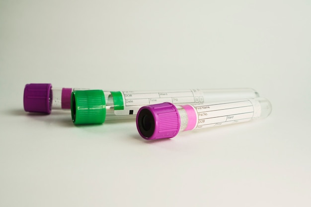 vacuum tubes for collection and blood samples on white background
selective focus