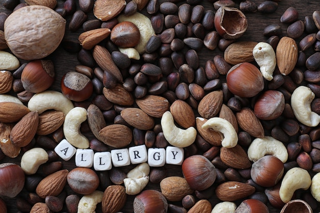 Various useful and tasty nuts on a wooden table and pots with green grass