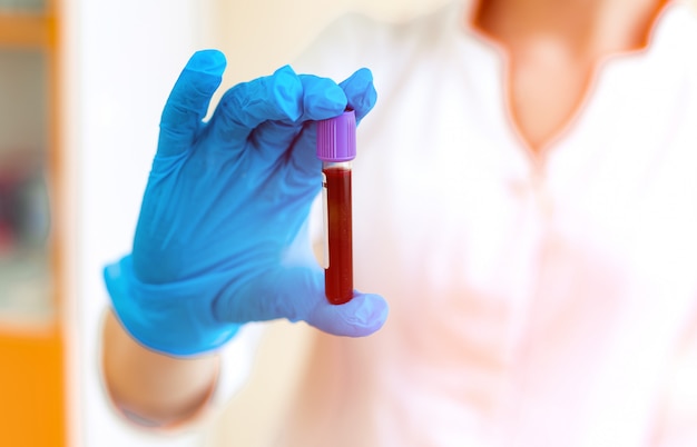 Vial full of blood in the hand of a laboratory specialist. Woman's hand in blue protective glove is holding a test tube with red liquid. Close-up.