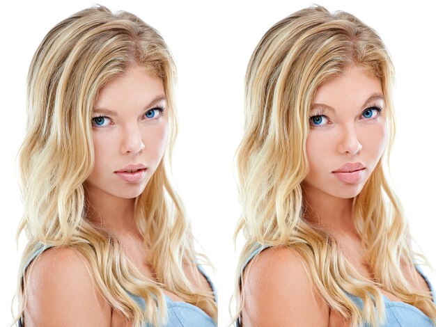 Photo who said beauty cant be bought comparative composite image of a before and after plastic surgery picture of a young woman