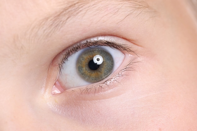 Wide open child's eye with an eyebrow and moles on skin.