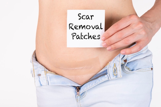 A woman applied a silicone-coated patch to a cesarean section scar to remove keloid scars