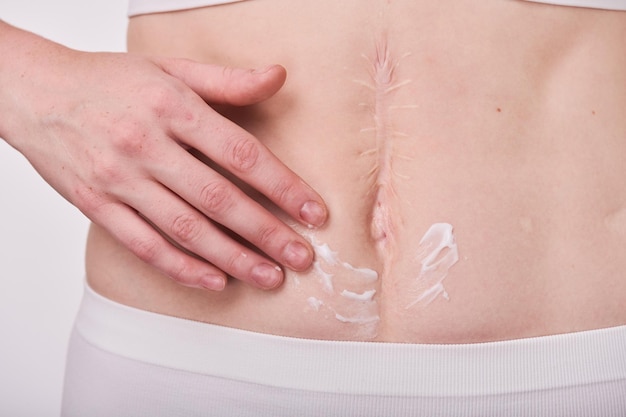 Woman applying cream on belly