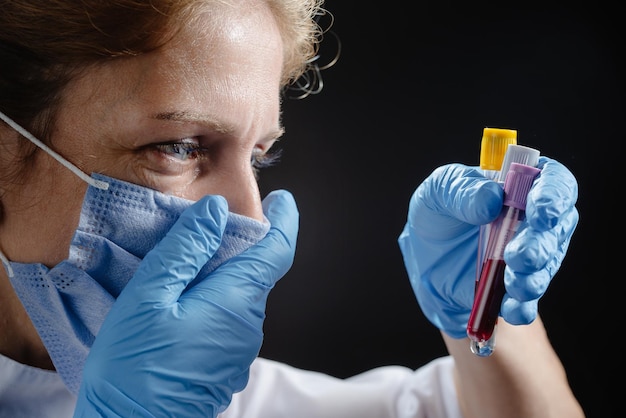 A woman doctor in a protective medical mask looks at the blood tubes and cries the doctor cries when