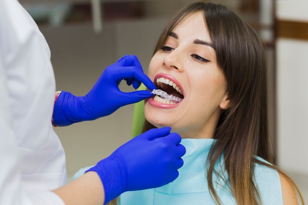 Woman getting invisible retainers at dentist