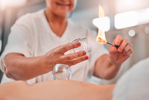 Woman hands or flame for cupping therapy in spa hotel salon or holistic Chinese treatment for pain relief muscle stress or injury Zoom massage therapist or fire in glass cup for wellness healing