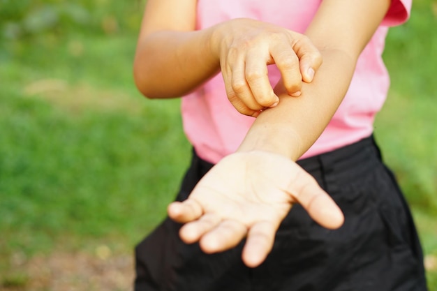 woman itchy arm