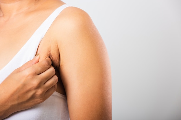 Woman pulling her skin underarm she problem armpit fat underarm wrinkled skin