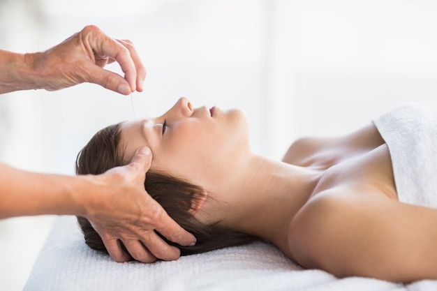 Woman receiving acupuncture treatment