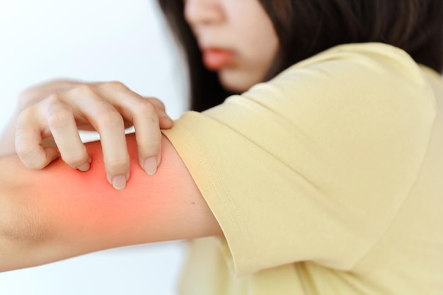 A woman's hand is scratching her arm due to an allergic reaction or a skin disease