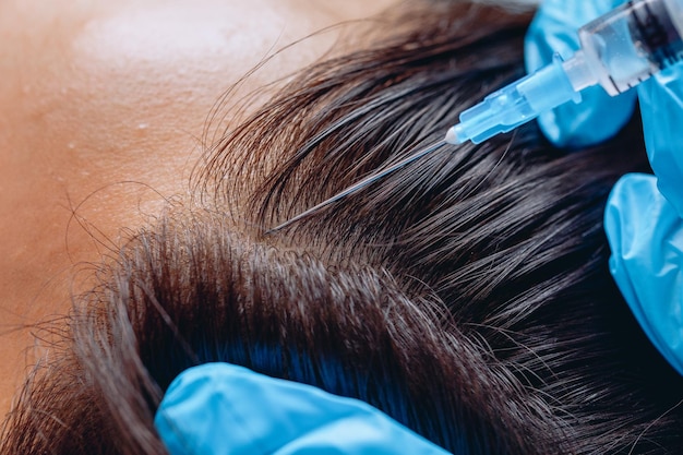 A woman's head in macro photography. The hands of a skilled cosmetologist make injections to increase hair growth.