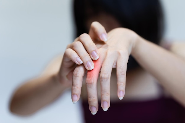 Woman's knuckle pain Signs of osteoarthritis