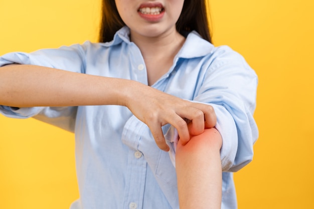 A woman scratching her arm