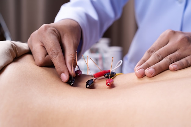 Woman undergoing acupuncture treatment with electrical stimulator on back