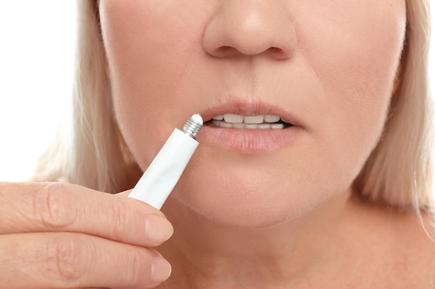 Woman with cold sore applying cream on lips against white background closeup