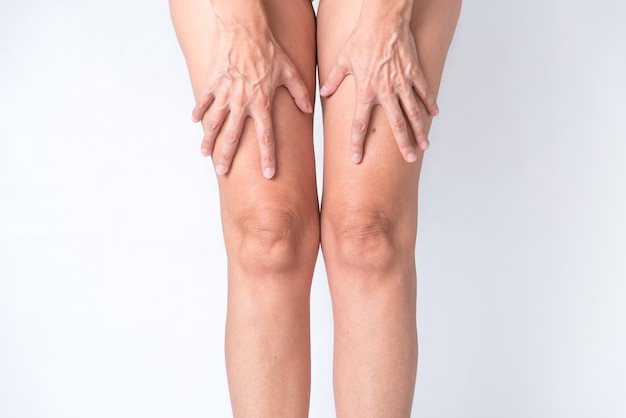 woman with deformity in the legs and knees crooked