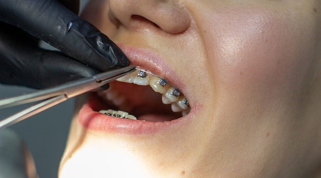 A woman with dental braces visits an orthodontist in the clinic in a dental chair