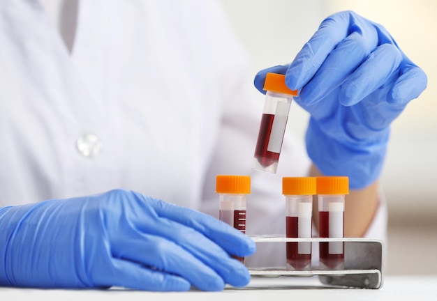 Woman working with blood samples in laboratory closeup