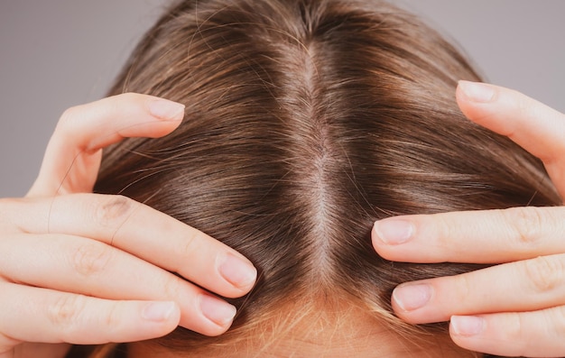 Woman worried about hair loss Hair fall problem