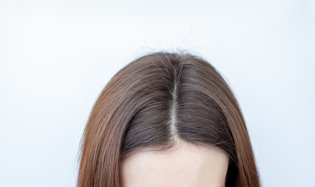 A womans head with a parting of gray hair