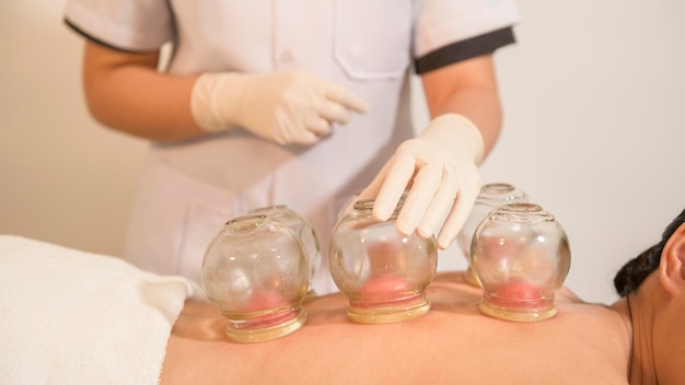 XABeautiful Woman Received cupping treatment on back by therapist chinese medicine