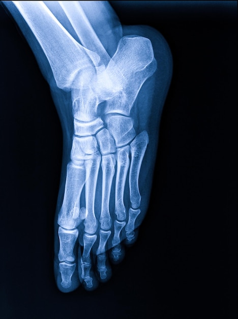 Photo xrays of the human foot highlighted in red