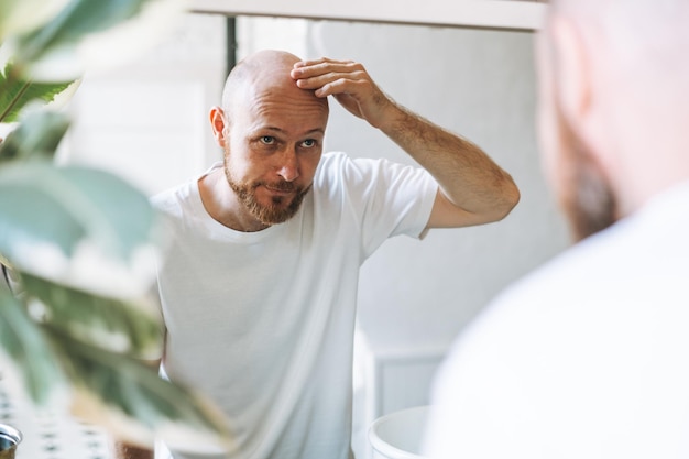 Photo young adult bearded man looking in mirror in bathroom touching head worried about about hair loss