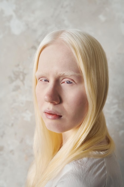 Young beautiful albino woman with no makeup looking at camera