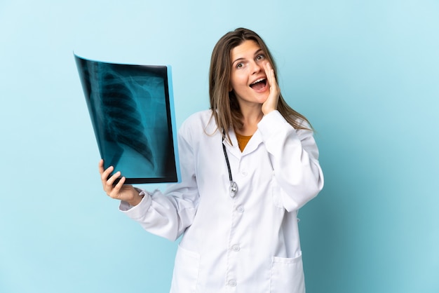 Young doctor woman holding radiography over isolated background shouting with mouth wide open