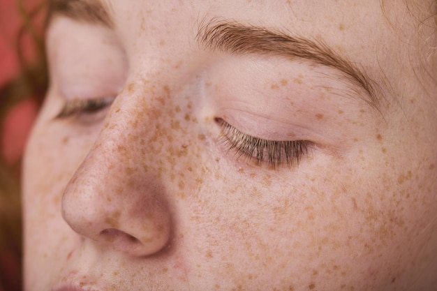 Young female face with freckles