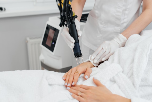 A young girl gets carbon peeling for the skin of her hands in a beauty salon Laser pulses cleanse the skin Hardware cosmetology The process of photothermolysis warming the skin