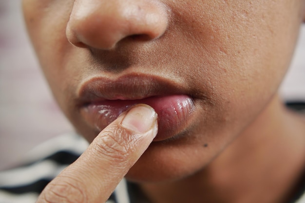 Young man applying moisturising lip balm on lips