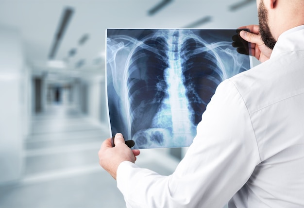 Young man doctor holding x-ray