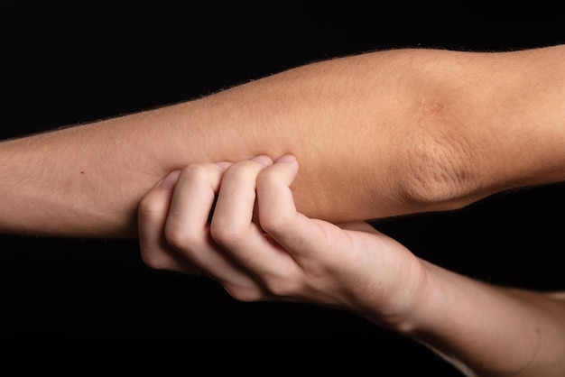 Young man scratching his arm with his hand Skin disease Irritation allergy