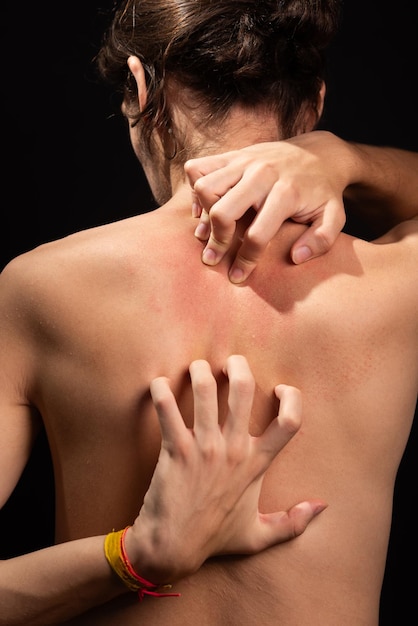 Young man shirtless scratching his back with his hands Skin disease Irritation allergy