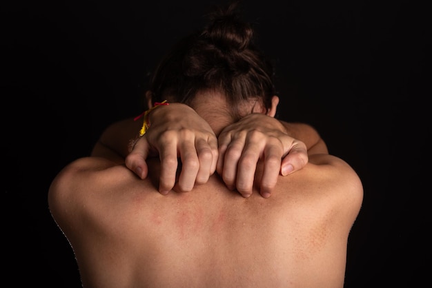 Young man shirtless scratching his back with his hands Skin disease Irritation allergy