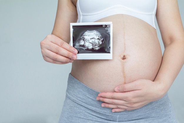 Young pregnant woman holding her ultrasound in the last trimester of pregnancy