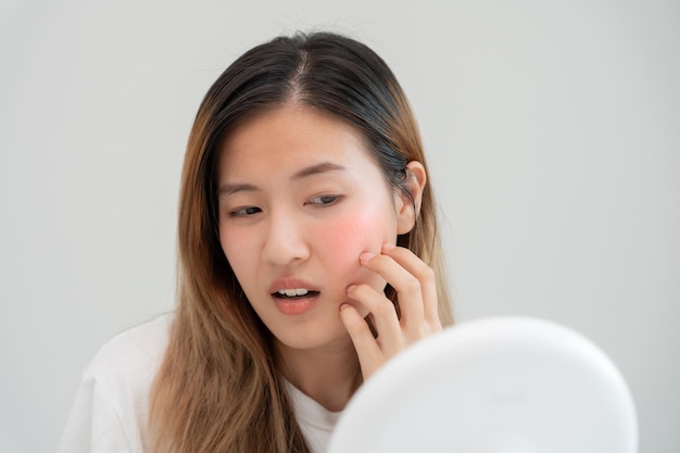 Young woman are worried about faces Dermatology and allergic to steroids in cosmetics sensitive skin red face from sunburn acne allergic to chemicals rash on face skin problems and beauty