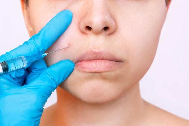 Young woman and doctor hand in blue glove holding syringe needle for lifting on the nasolabial fold