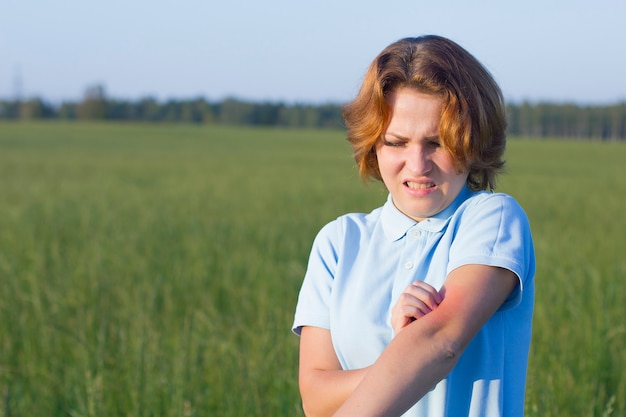 Photo young woman has allergic reaction to insect, mosquitoes bites. woman scratches her hand, redness on the skin. girl suffers from skin irritation, allergy outdoor, summer day in field