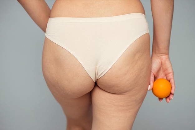 Young woman holding an orange on a light background Cellulite problem concept